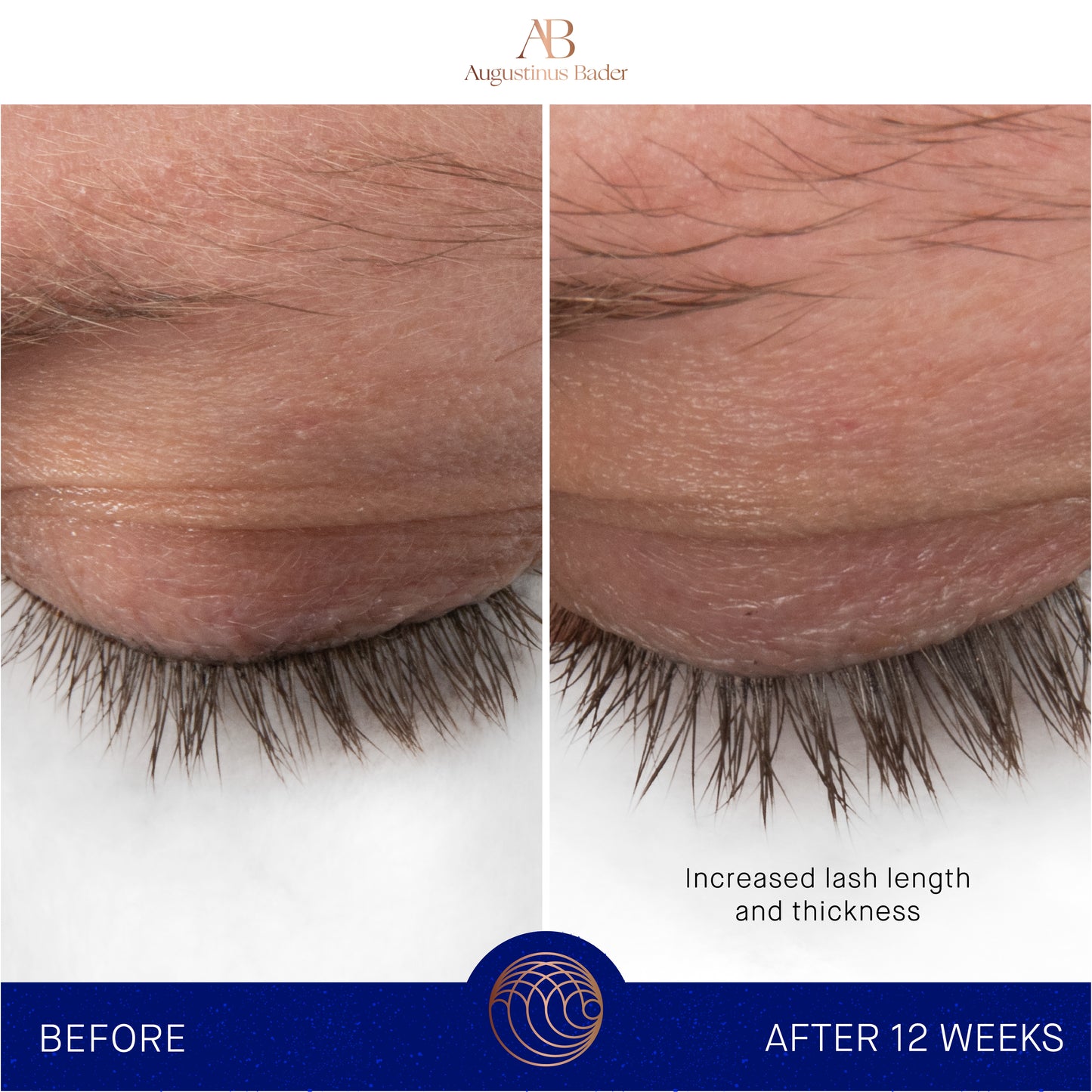 THE EYEBROW & LASH ENHANCING SERUM