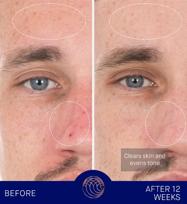 THE RETINOL SERUM - 15ml