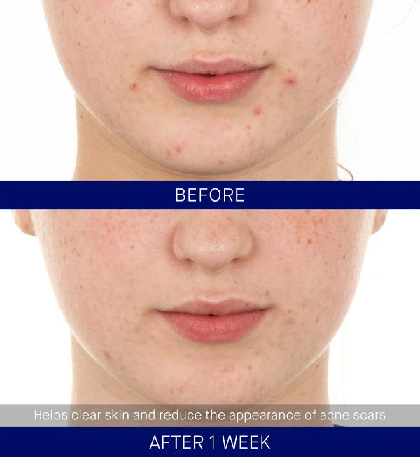 THE RETINOL SERUM - 15ml