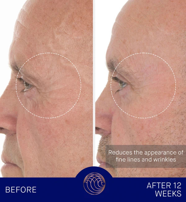 THE RETINOL SERUM - 15ml