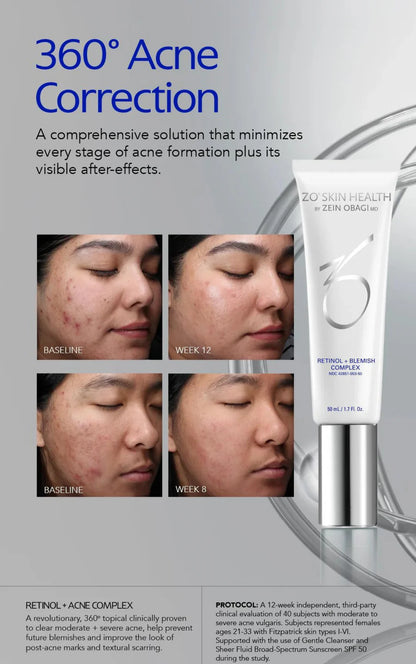 Retinol + Blemish Complex NEU